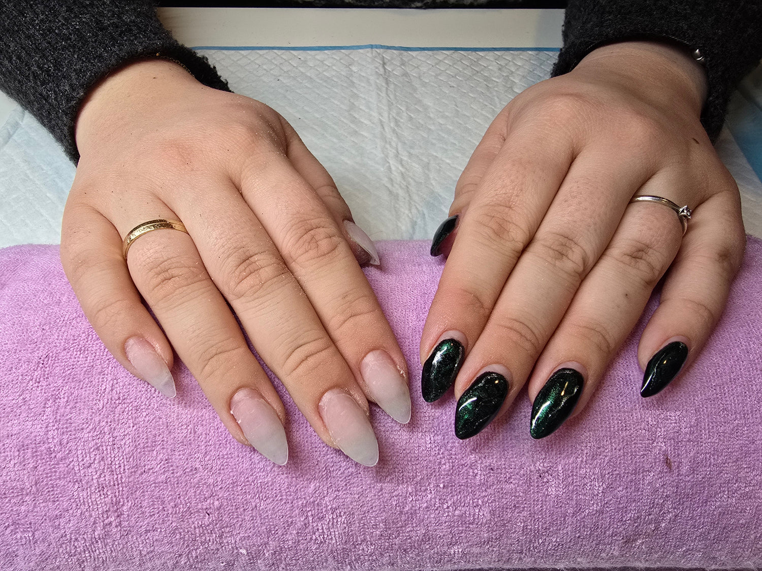 Gel